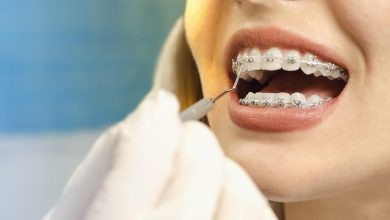Photo of Visiting an orthodontist in the Upper East Side: What to expect?