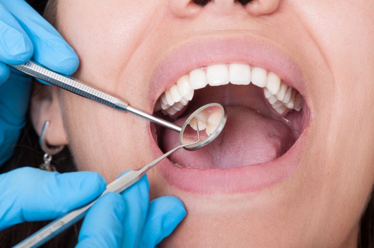 COMMON DENTAL PROBLEMS